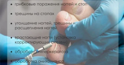 Подология